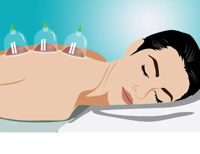 cupping therapy hijama therapy